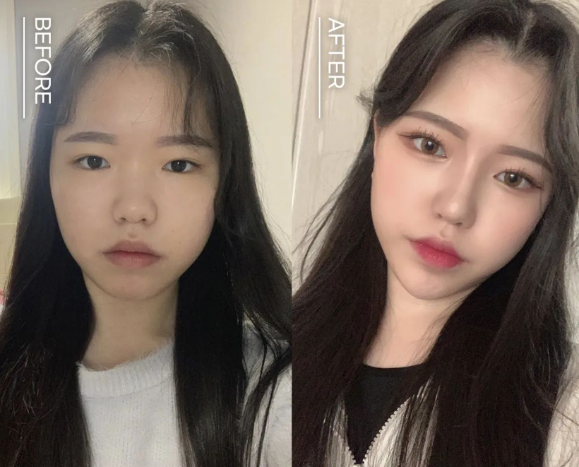 여자코성형후기 얼굴 비율까지 고려하여 관련 이미지 8