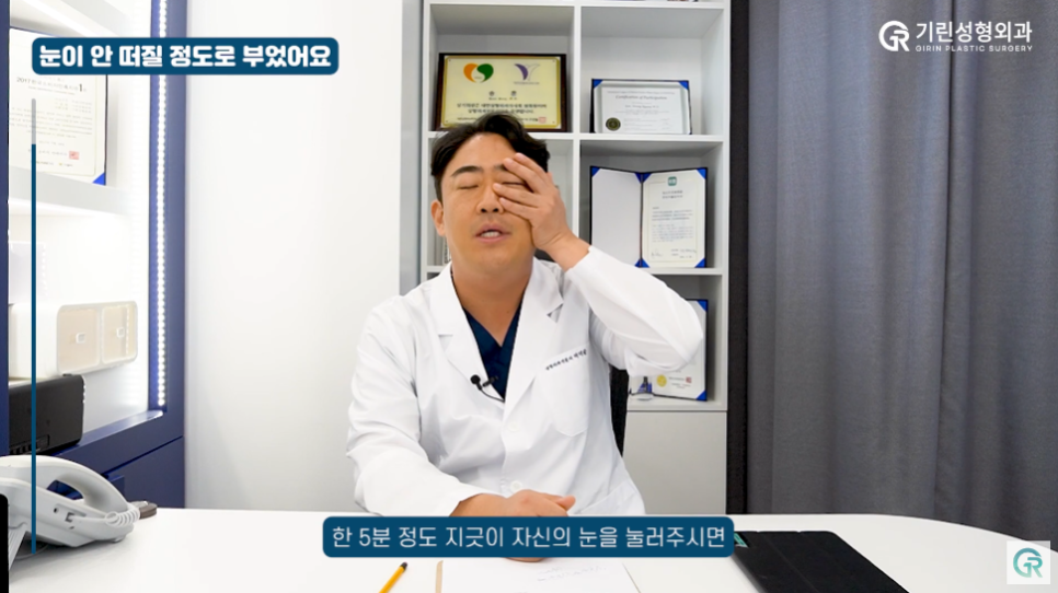 [기린성형외과] 내 눈은 망한걸까 부기일까?_눈성형 Q&A 관련 이미지 15