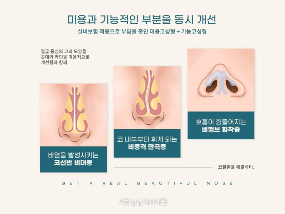 비중격만곡증코성형 같이 진행하고 싶으면 관련 이미지 3