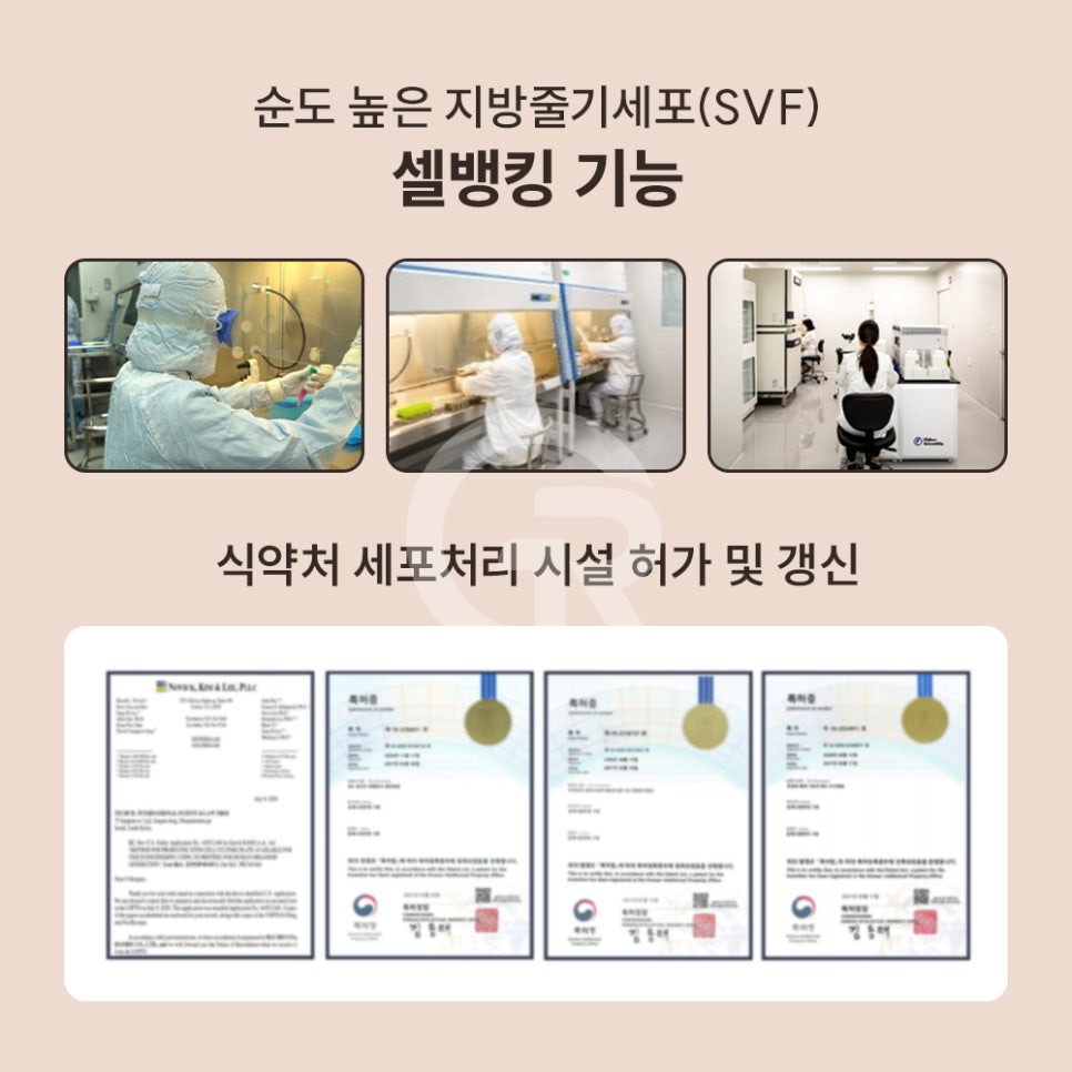 "머리숱이 없어요" 가르마 탈모 환자 줄기세포 주사 관련 이미지 8