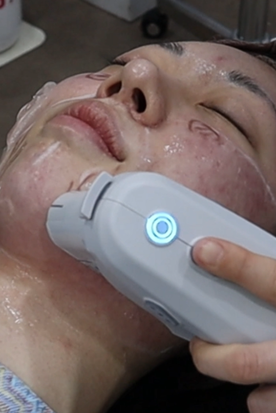 일요일에도 리프팅 가능한 이유 기린성형외과 관련 이미지 7