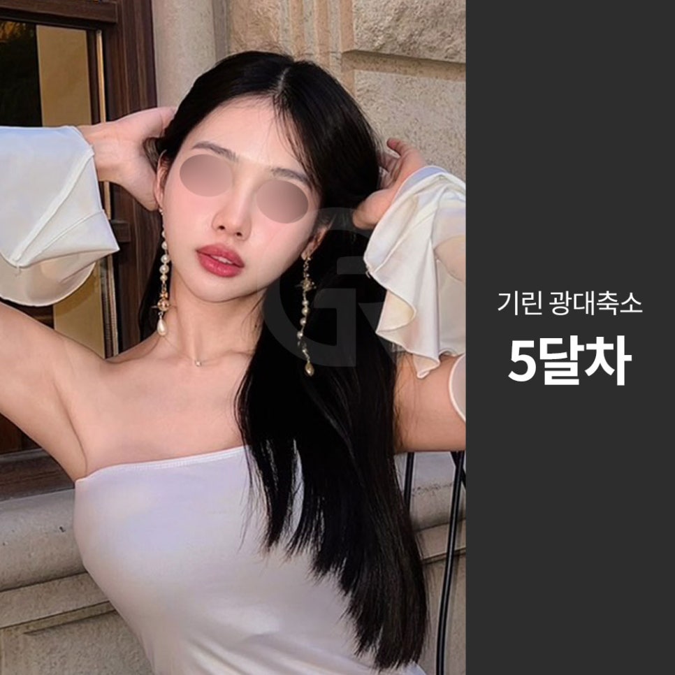 광대가 큰 얼굴, 축소술은 인상을 조율하는 기준점입니다 관련 이미지 7