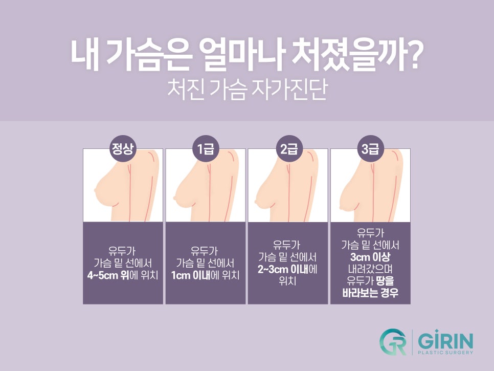 가슴거상술 변화를 기대하며 관련 이미지 9