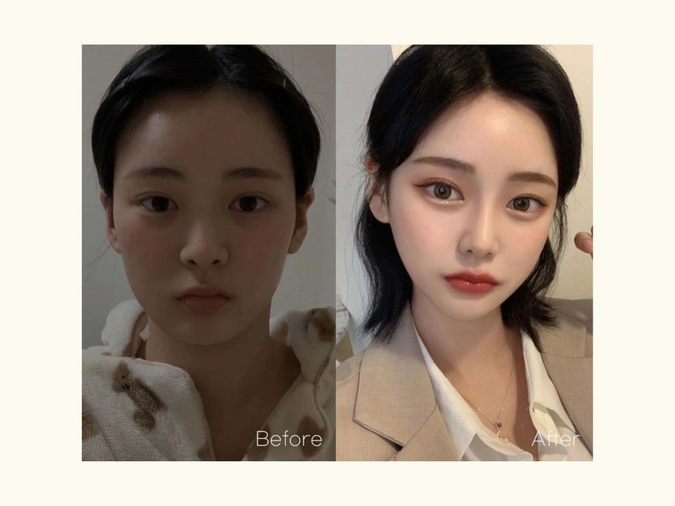 코성형외과유명한곳 조화롭게 달라지는 관련 이미지 11