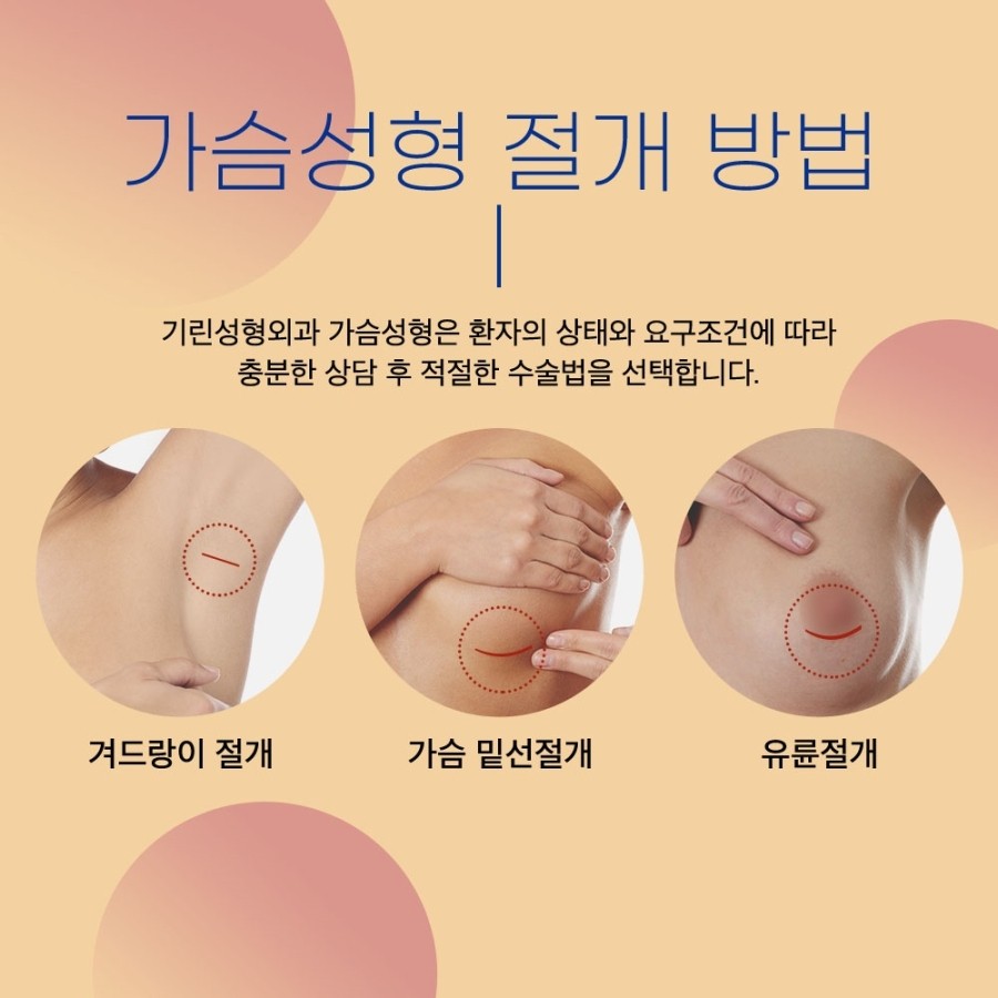 가슴수술잘하는병원 안전하고 아름답게 관련 이미지 2