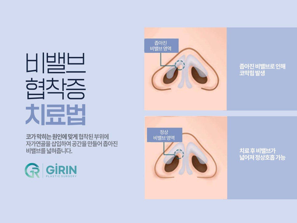 강남성형외과순위 선택은 신중하게 관련 이미지 9