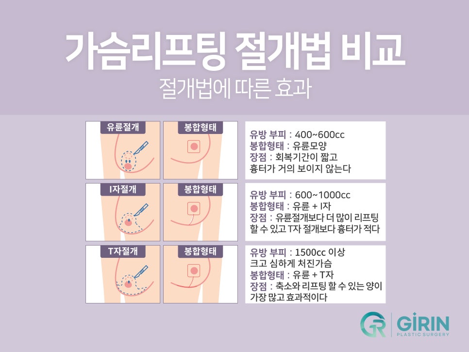가슴거상술 변화를 기대하며 관련 이미지 8