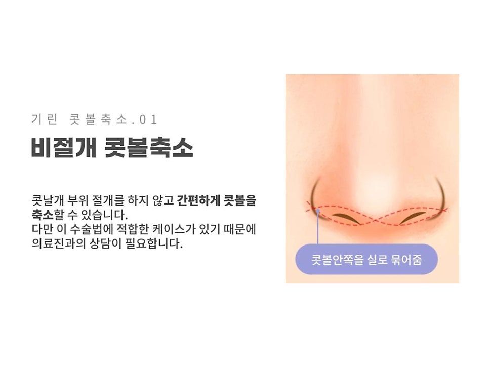 서울코수술 생김새에 따라 다르게 관련 이미지 10