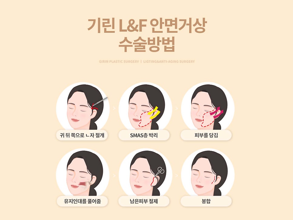 안면거상술잘하는병원 자세히 알아본다면 관련 이미지 11