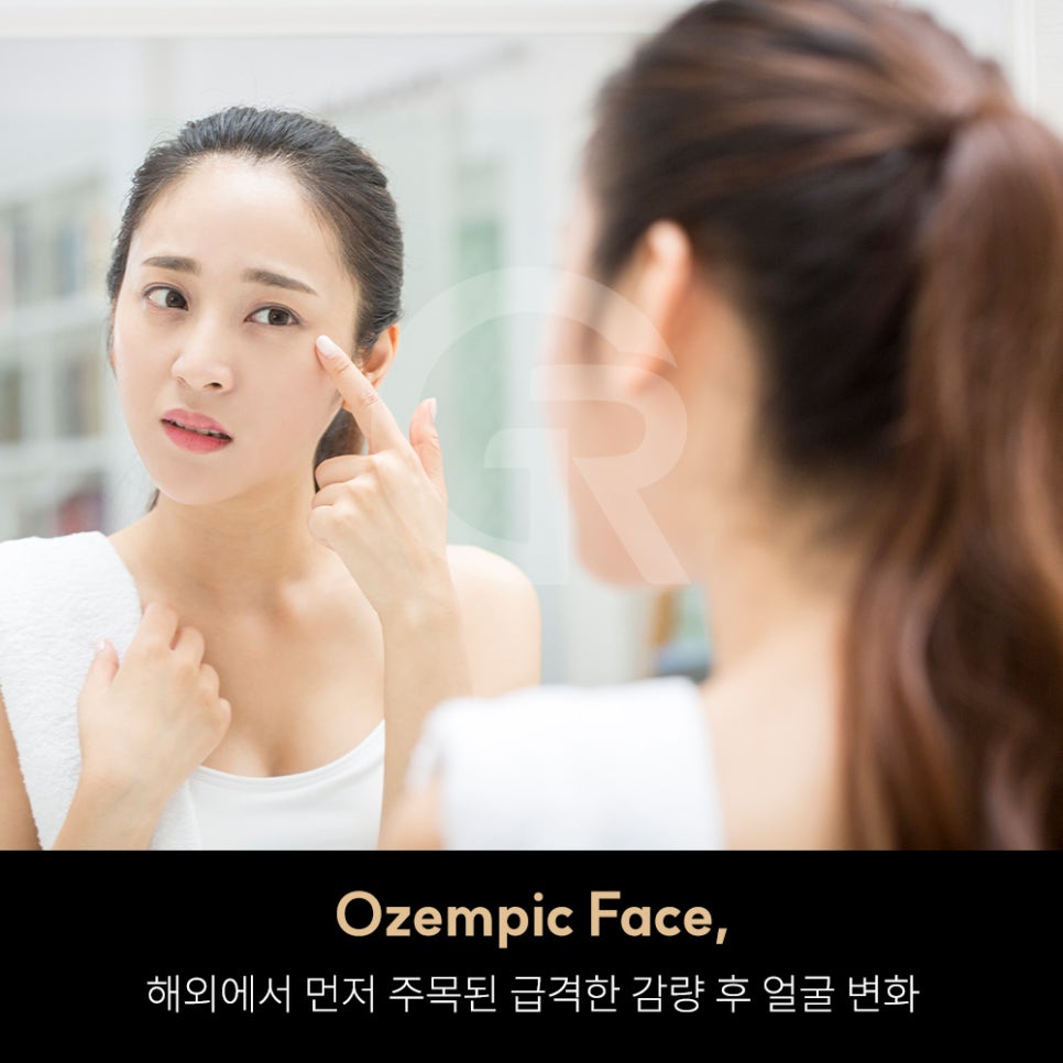 위고비&middot;마운자로 후 얼굴처짐으로 인한 미니거상 후기 관련 이미지 2