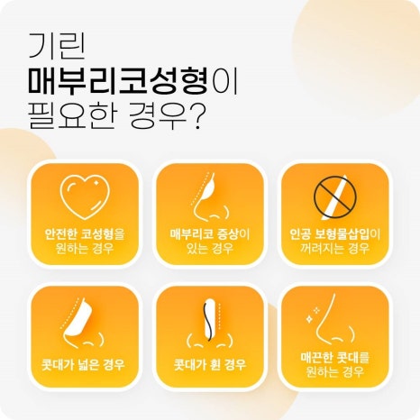 매부리코수술? 콧대만 깎는다고 해결 될까? 관련 이미지 4