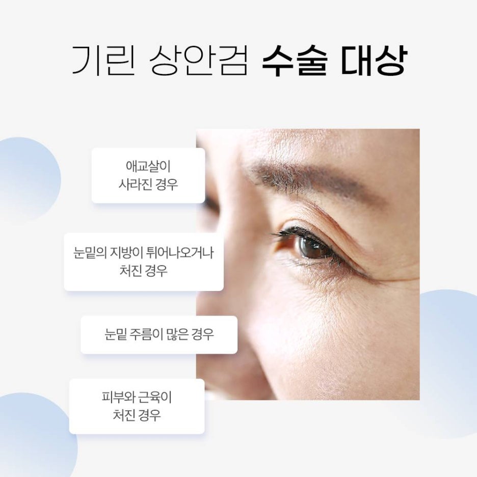 상안검수술잘하는곳 이유가 있다! 관련 이미지 3
