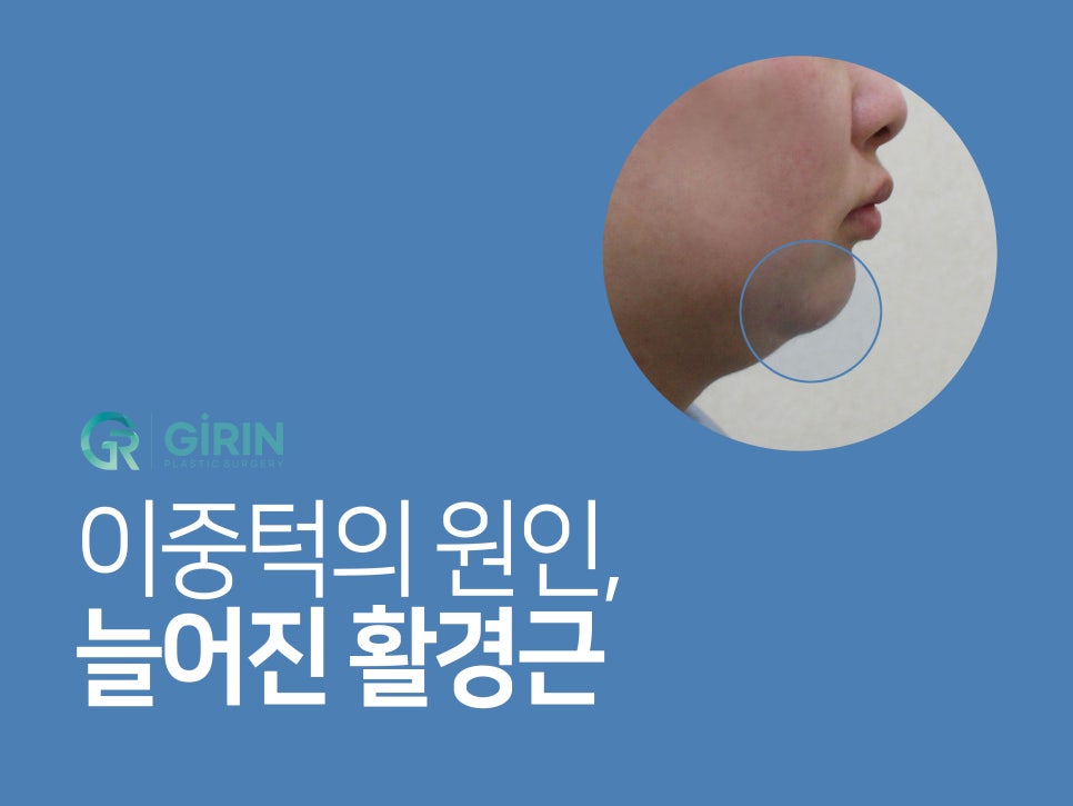 이중턱근육묶기 탄력 저하 잡아주는 관련 이미지 3
