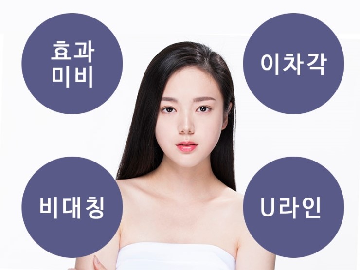 안면윤곽재수술 시 고려해야 할 점 관련 이미지 4