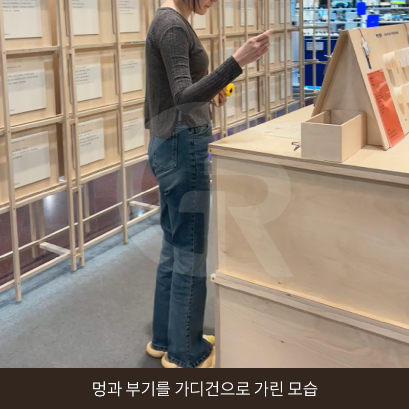 요가로 소용없던 굵은 팔뚝 지방흡입 수술 후기 관련 이미지 12