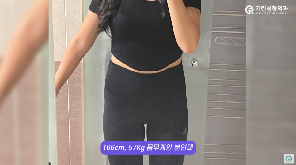 [기린성형외과의원] 빼고 싶은 부위는 빼고, 넣고 싶은 부위에 넣는 지방이식 수술일지 관련 이미지 3