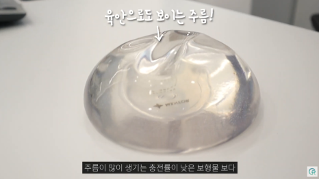 [기린성형외과의원] 자연스럽고 만족스러운 결과_마른체형의 가슴성형 수술일지 관련 이미지 6