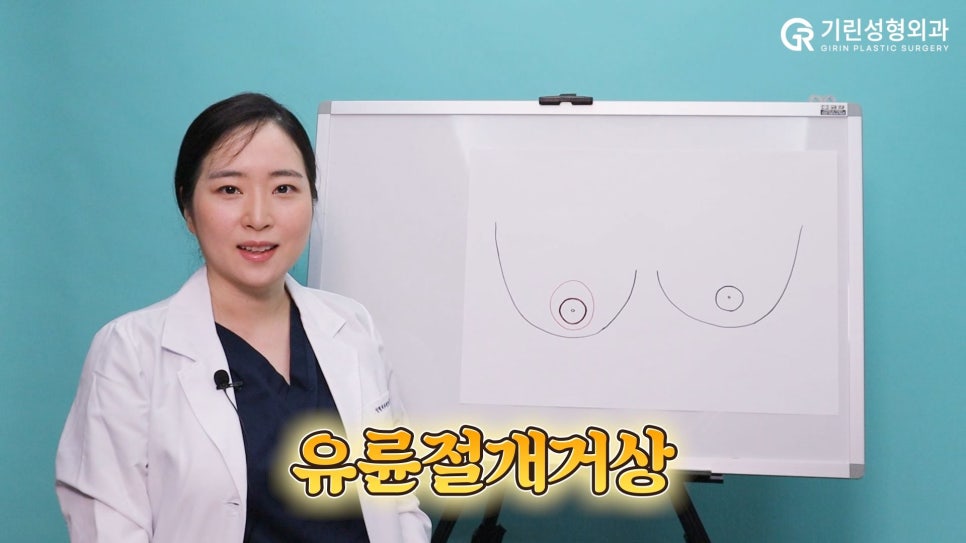 [기린성형외과]가슴거상_처진가슴 자가 진단법 및 수술법 관련 이미지 6