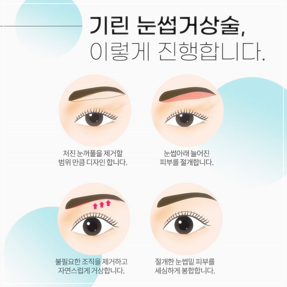 눈썹리프팅 나만알던 동안비결 관련 이미지 7