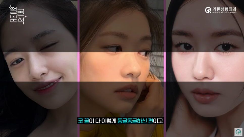 [기린성형외과의원]_자매 아닌가요? 안유진, 정소민, 안은진 얼굴분석 관련 이미지 8