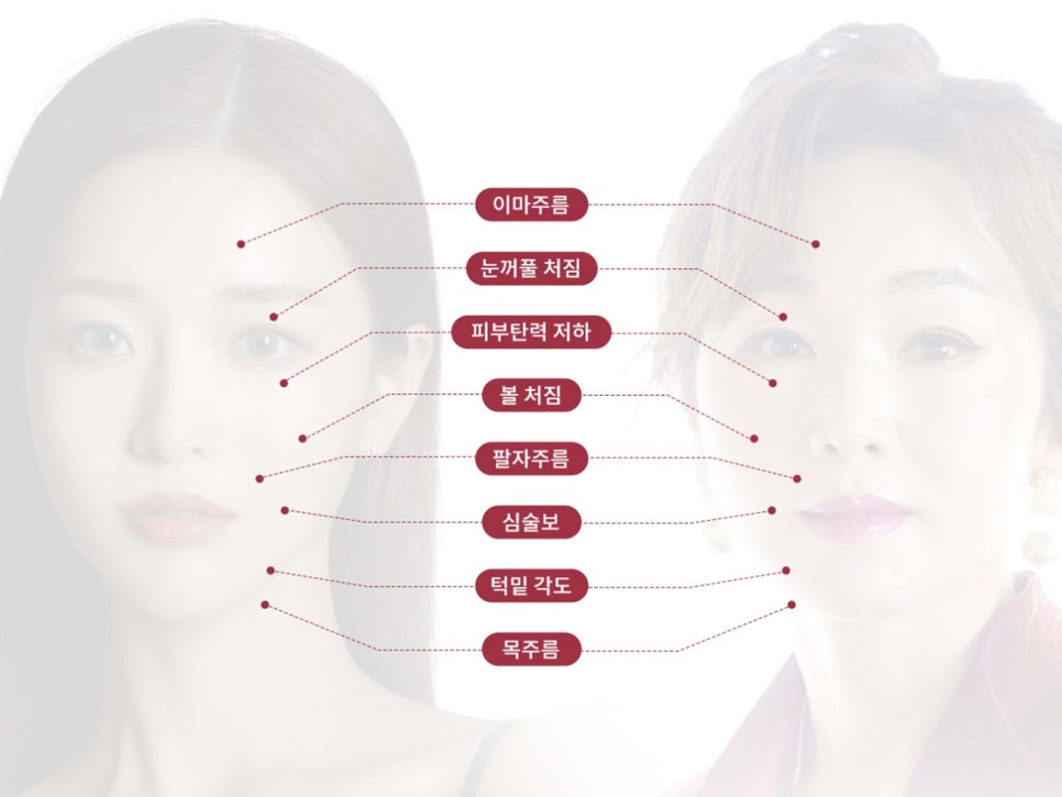 안면거상술잘하는병원 자세히 알아본다면 관련 이미지 4