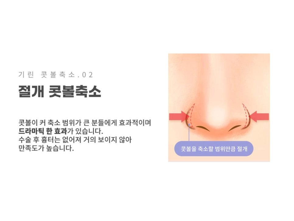 서울코수술 생김새에 따라 다르게 관련 이미지 11