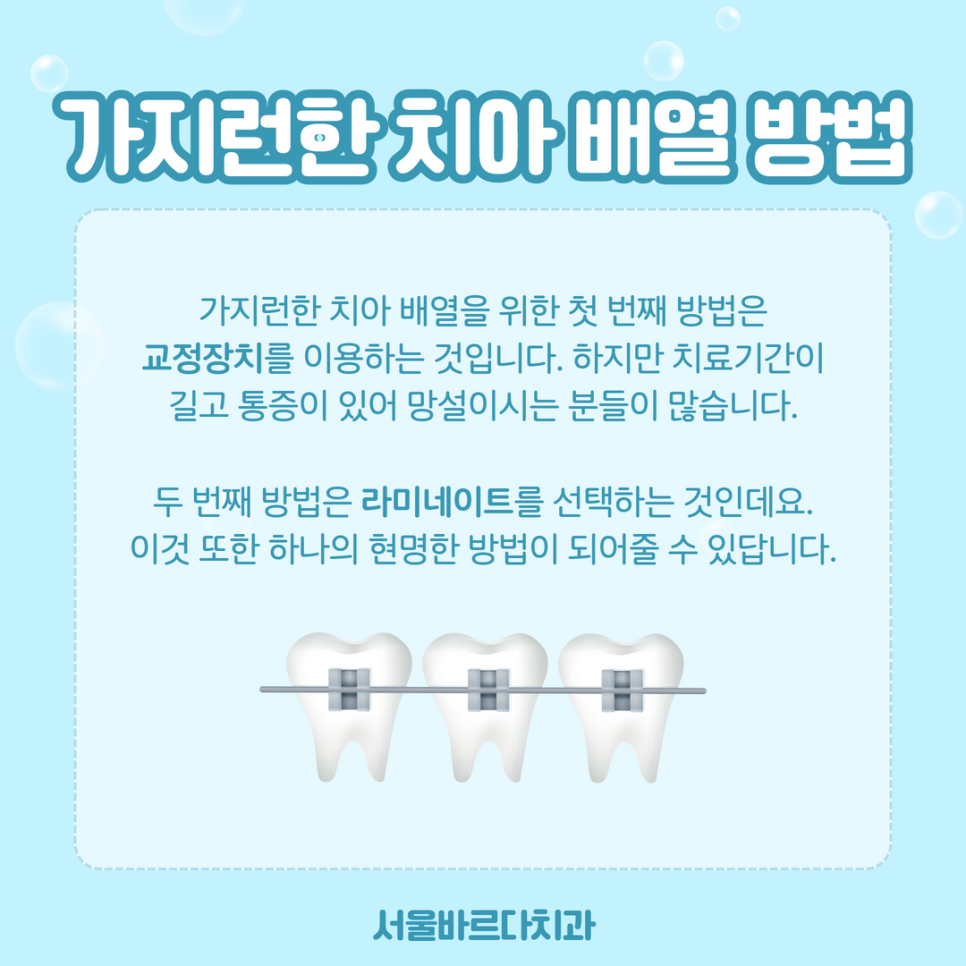 고덕치과 무삭제 라미네이트, 치아를 깍지 않아도 가능하다? 관련 이미지 4