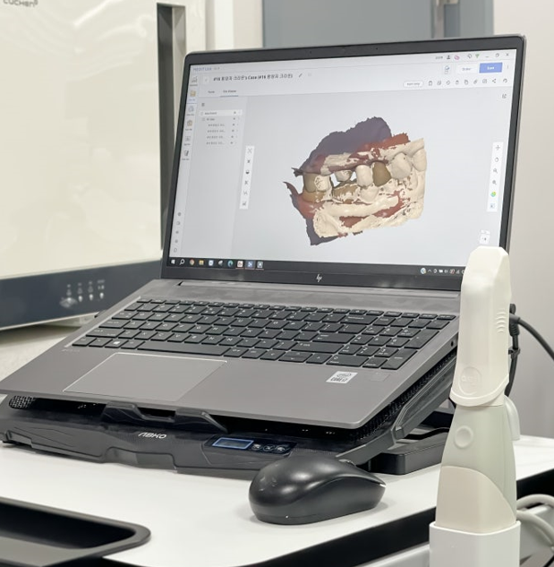 명일역 치과 보철 대표원장이 직접 제작합니다. 관련 이미지 3