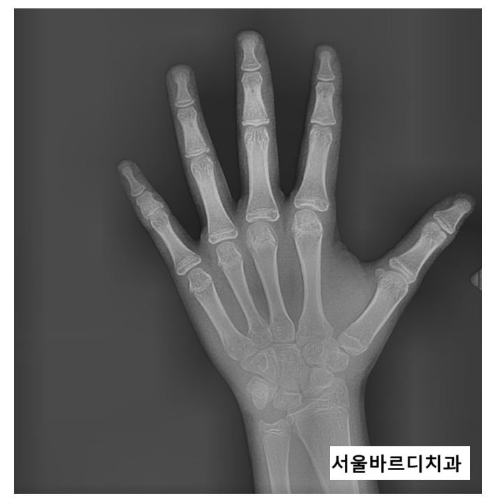 명일동 치아 교정 타이밍 언제 시작하는게 좋을까? 관련 이미지 2