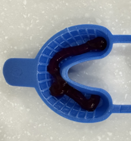 치아에 생긴 하얀 얼룩, 왜 생기나요? 초기 충치일 수 있습니다. 관련 이미지 5