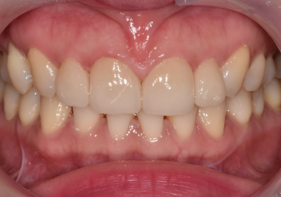 강일동 라미네이트 가격 망설여질 때 꼭 확인해야 할 관련 이미지 7