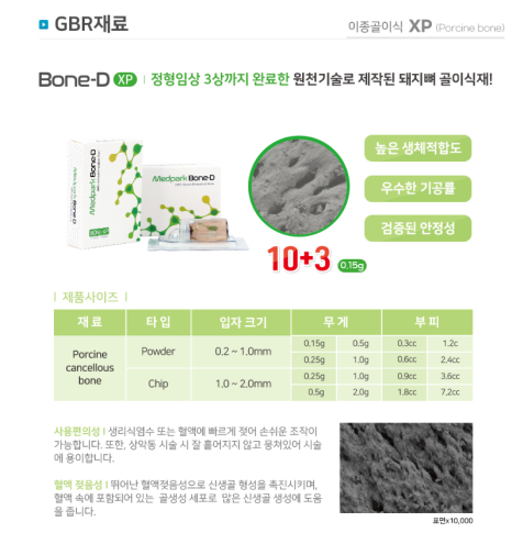 강일동 임플란트 뼈이식재 종류는 뭔가요? 안전성이 걱정되신다면 필독 관련 이미지 5