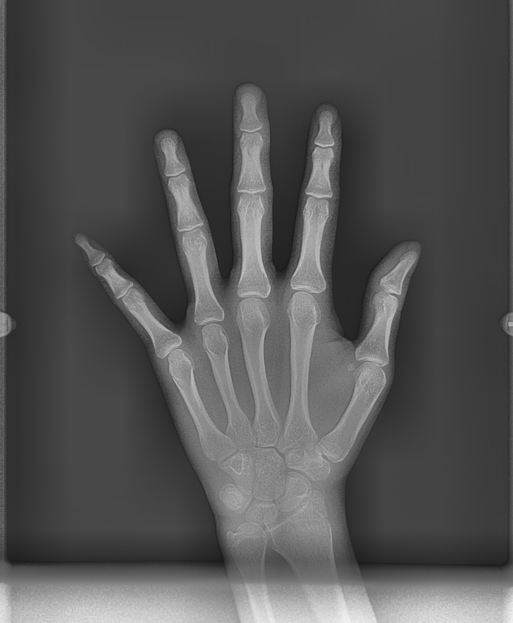 어린이 치아교정 시기 언제가 적기일까?? 관련 이미지 4