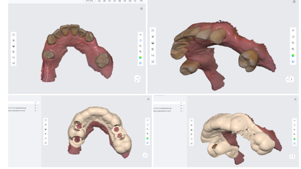서울 네비게이션 임플란트 치과 불안할 때 좋은 선택지가 될 수 있습니다. 관련 이미지 3