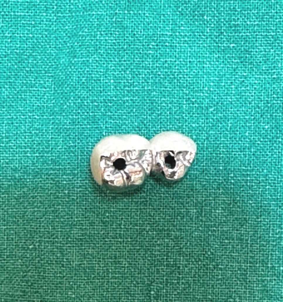 천호동 치과 임플란트 크라운 종류 설명 나갑니다. 관련 이미지 7