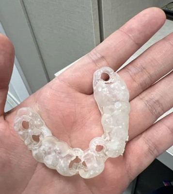 강동구 임플란트 어금니 상실 방치하다 치매까지 옵니다. 관련 이미지 10