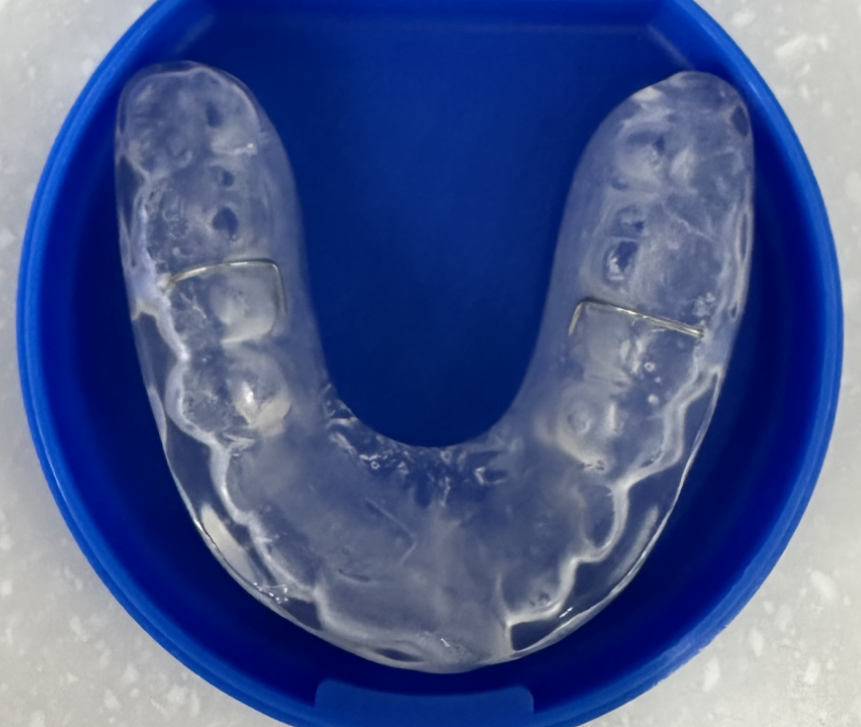 상일동역 턱관절 명절 음식 조심히 드세요!!!! 관련 이미지 4