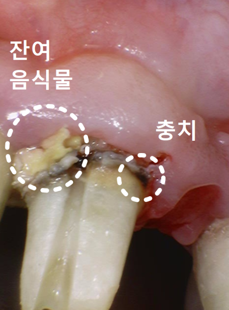 음식물 끼임, 거뭇한 무언가 보인다면? 이미 늦었을 수 있습니다. 관련 이미지 6