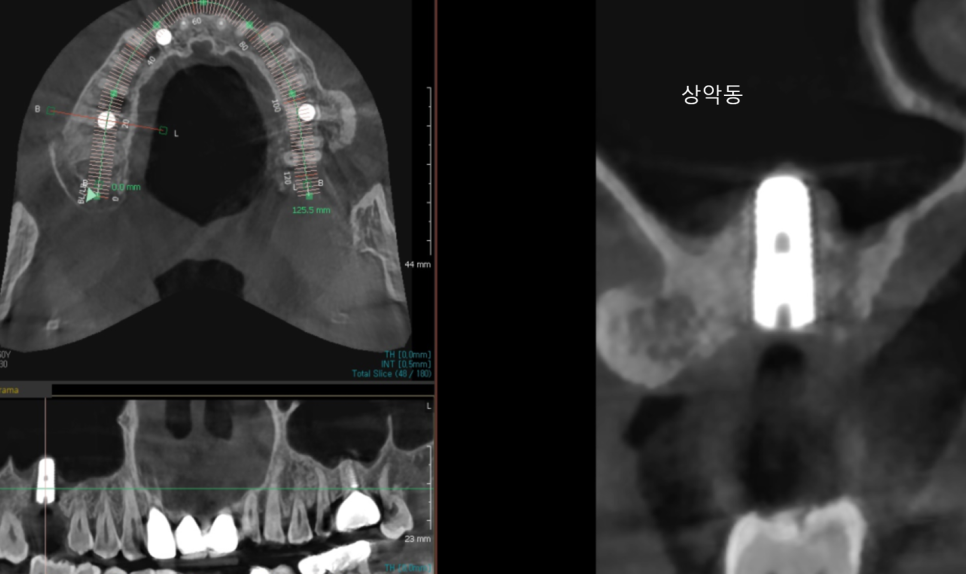 고덕동 임플란트 제발 아무데서나 하지 마세요! 관련 이미지 2