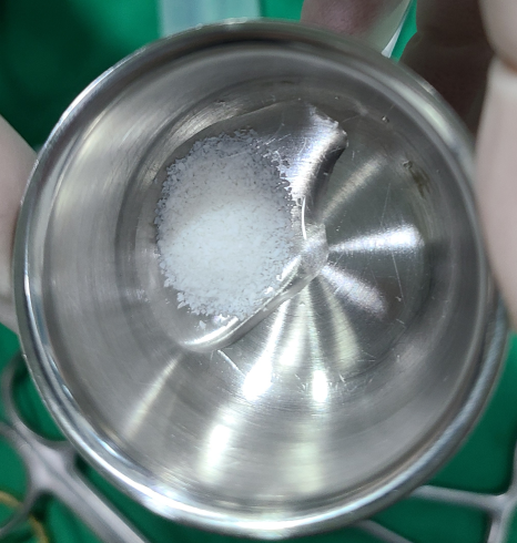 망월동 치과 임플란트 수술 후 궁금하신 부분 전부 알려드려요 관련 이미지 5