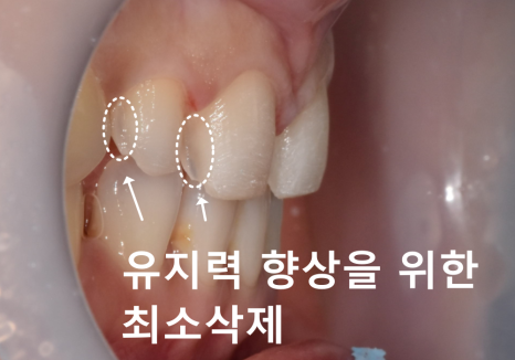 강일동 라미네이트 가격 망설여질 때 꼭 확인해야 할 관련 이미지 6