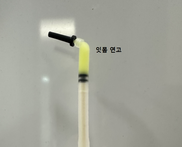 잇몸 주저앉음 발치하게 되는 제일 큰 원인이기에 잇몸치료 과정 공개 관련 이미지 8