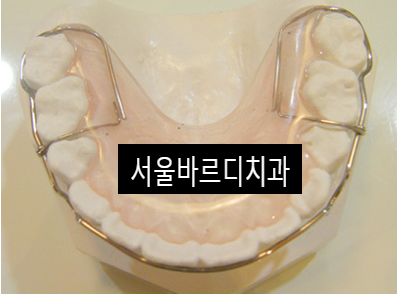 강동구 치아교정 병원에서 물어봐야할 필수 질문 4가지 관련 이미지 5