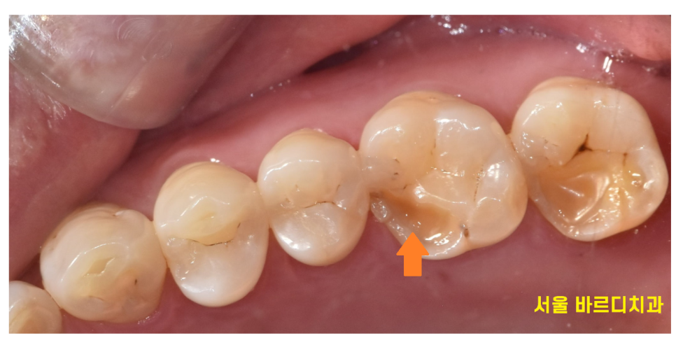 상일동역 턱관절 명절 음식 조심히 드세요!!!! 관련 이미지 3