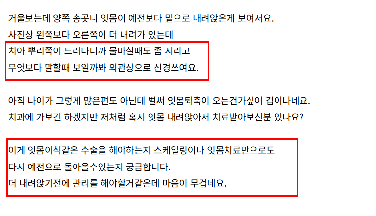 강동구 잇몸 퇴축으로 뿌리 드러난 치아, 이대로 둬도 괜찮을까? 관련 이미지 2