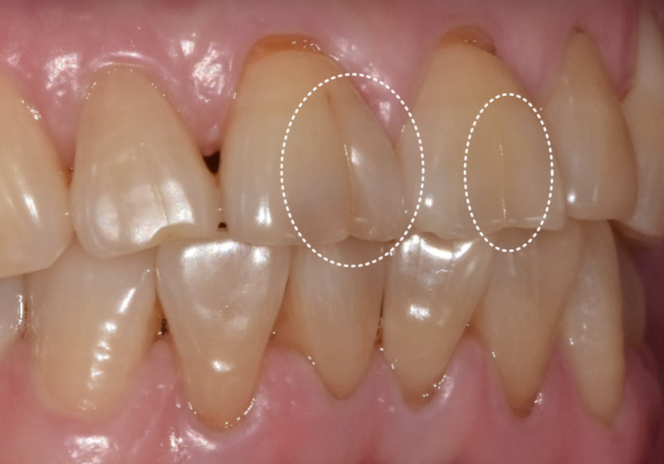 시큰거리는 통증, 시린 이 치약으로 해결 안 된다고요? 관련 이미지 2