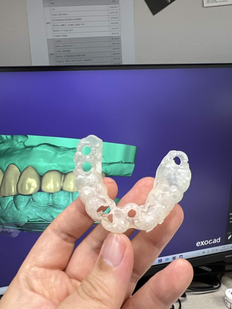 임플란트 1개 가격  무조건 저렴한 임플란트가 좋을까? 관련 이미지 5