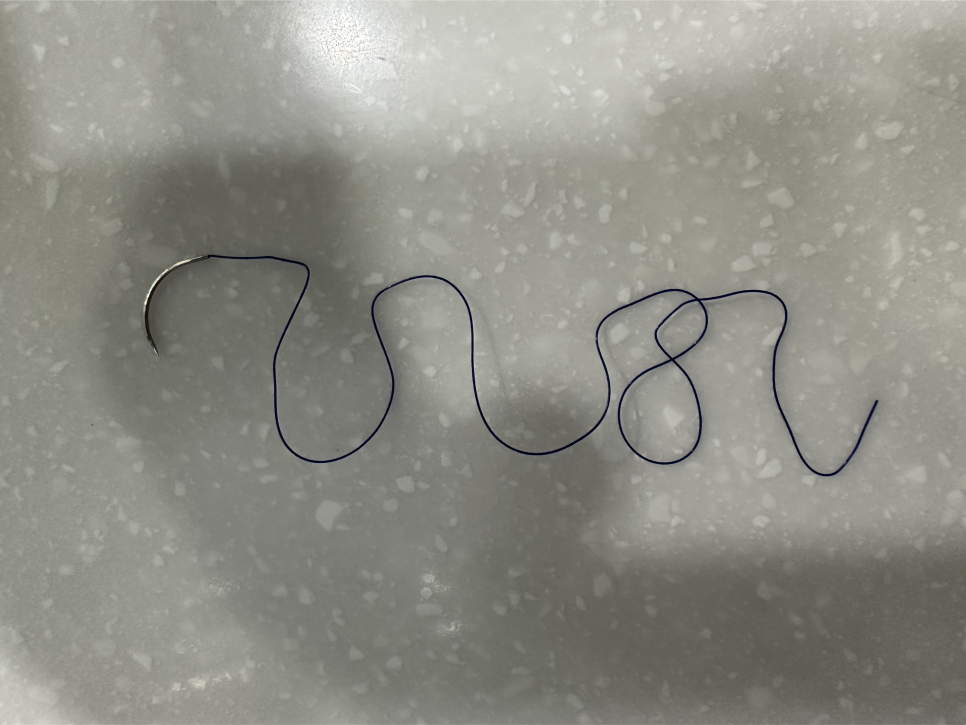 임플란트 실밥 언제 빼나요? 꺼끌거려서요 관련 이미지 2