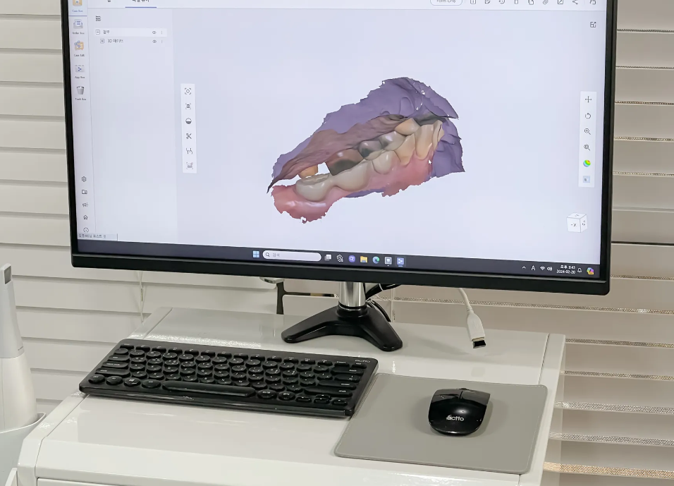 강동구 치과 임플란트 내원 전 5가지를 반드시 살펴보세요!! 관련 이미지 4