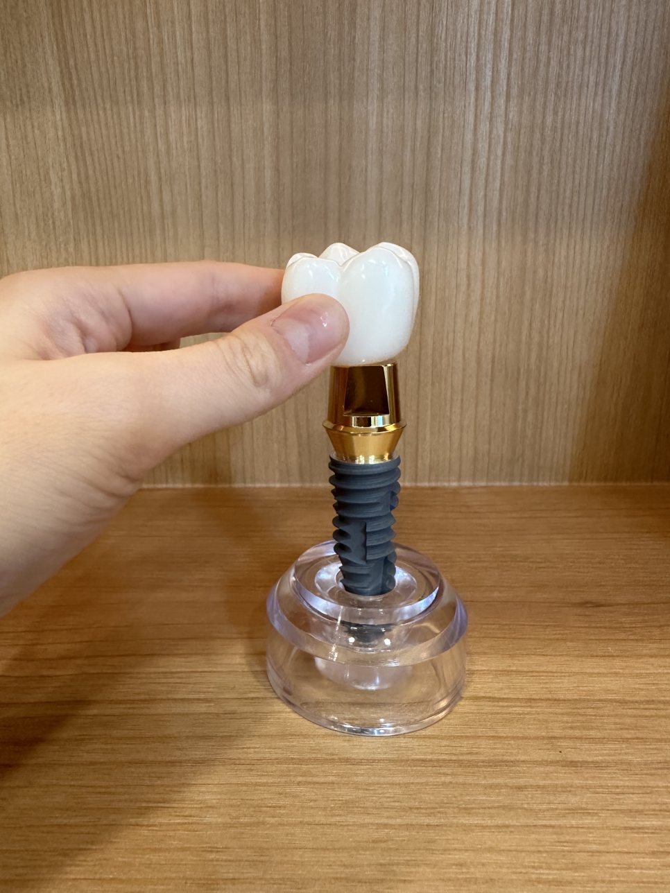 천호동 치과 임플란트 크라운 종류 설명 나갑니다. 관련 이미지 3